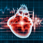 electrical-cardioversion